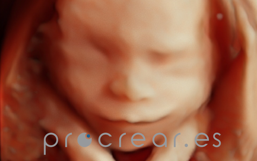 LA ECOGRAFÍA EMOCIONAL: Ecografías para fortalecer lazos y aliviar el estrés.